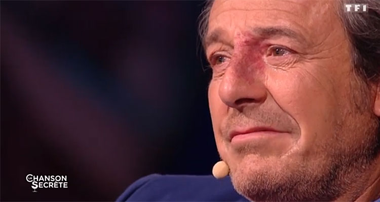 La chanson secrète (TF1) : Reichmann et Jarry en larmes, quel bilan d’audience pour Nikos Aliagas ? La chanson secrète (TF1) : Reichmann et Jarry en larmes, quel bilan d’audience pour Nikos Aliagas ?
